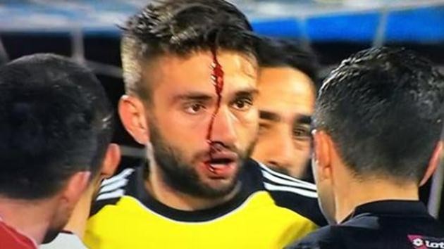  Ertuğrul Taşkıran-olay