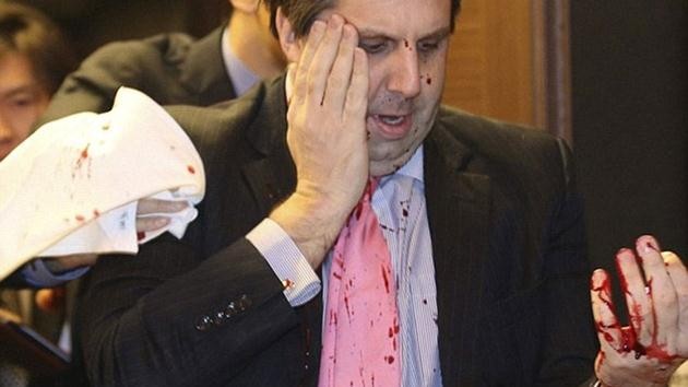ABD Güney Kore Büyükelçisi Mark Lippert-saldırı