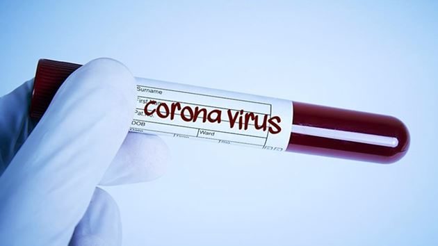 Türkiye’de corona virüse karşı alınan 19 önlem